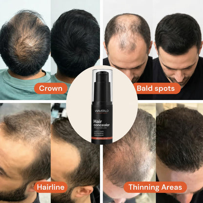 Waverlo Hair Density Filler