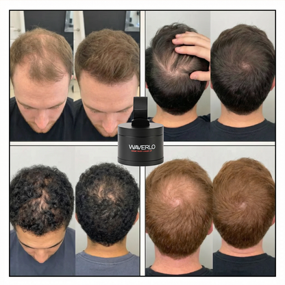Waverlo Hair Density Filler