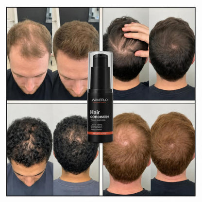 Waverlo Hair Density Filler